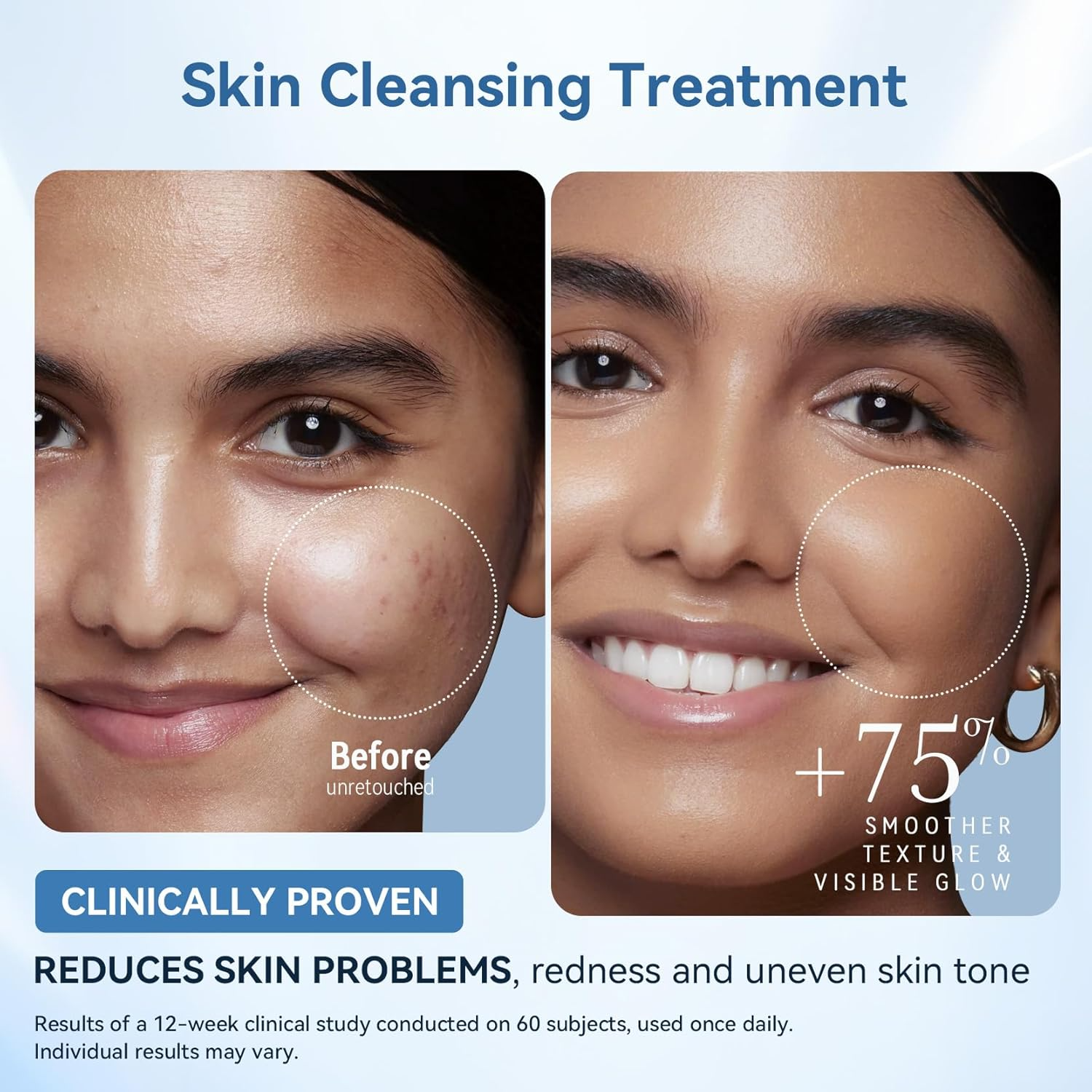 Sonic Glow Dermaplaning Razor